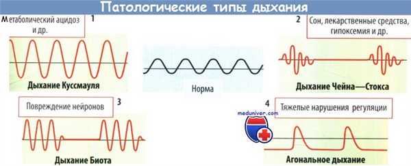Патологические типы дыхания
