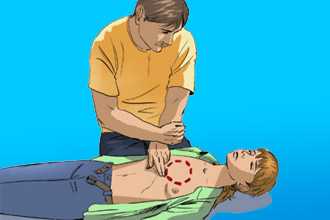 Оказание первой помощи