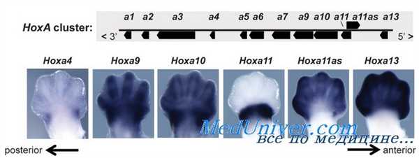 нарушения регуляции генов факторами транскрипции