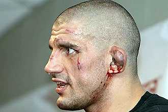 Травмы наружного уха