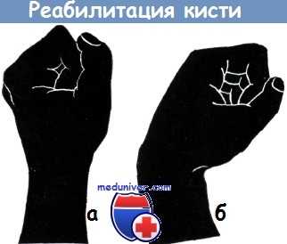 Реабилитация кисти