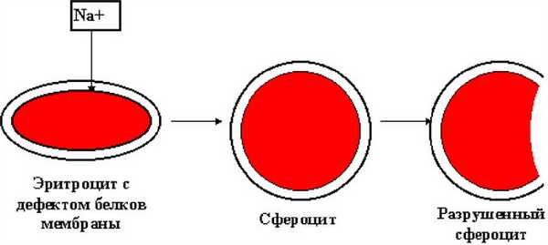 Микросфероциты