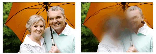 Макулодистрофия