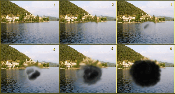 Возрастная макулярная дегенерация