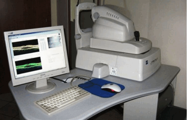 Оптическая когерентная томография