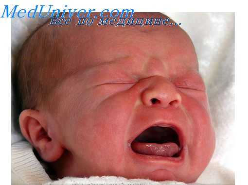 кардиопатии при синдроме марфана