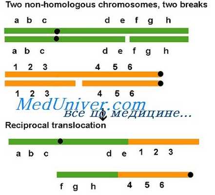 пролапс митрального клапана
