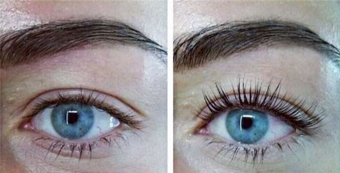 Ресницы до и после применения ботокса