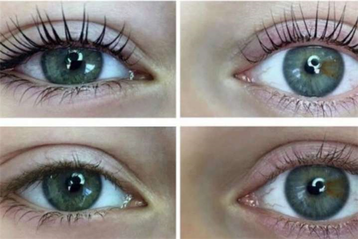 Преображение ресниц после процедуры с ботоксом