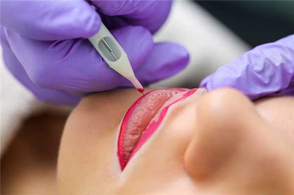 Шаг за шагом: как проходит процедура