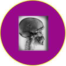 Рентгеновский снимок