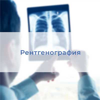 Рентгенография