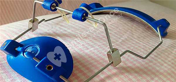 Лицевые дуги