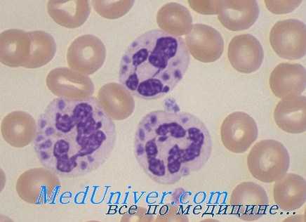 хроническая гранулематозная болезнь