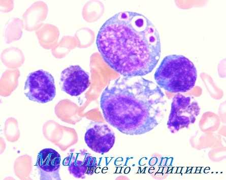 синдром чедиака-хигаси