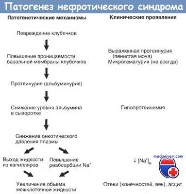 Патогенез нефротического синдрома