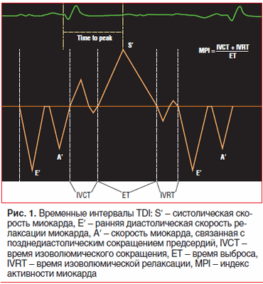 Рис. 1. Временные интервалы TDI: Sʹ - систолическая ско- рость миокарда, Eʹ - ранняя диастолическая скорость релаксации миокарда, Aʹ - скорость миокарда, связанная с позднедиастолическим сокращением предсердий, IVCT - время изоволюмического сокращения, ET