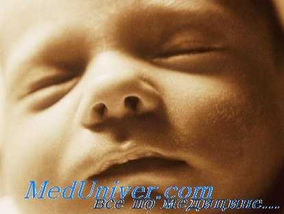 гепатит у детей