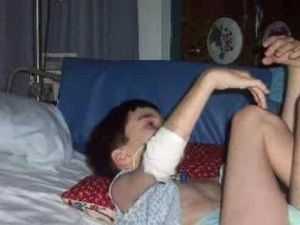 синдром Ленннокса-Гасто