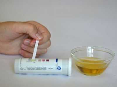 Определение ацетона в моче тест-полосками