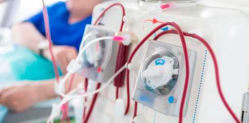 Гемодиализ - Алкоклиник