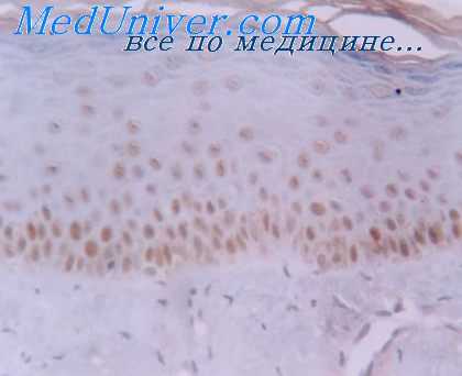 нервные окончания срединного шва