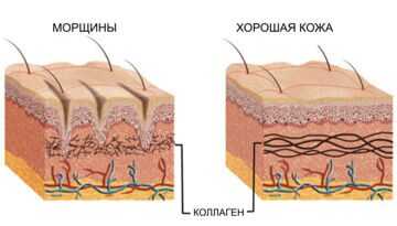Гидролизат коллагена вечная молодость кожи и суставов