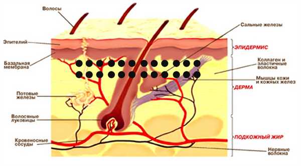 Строение простой коричневой родинки, не вызывающей опасения.