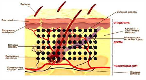 Строение черной родинки, которая часто вызывает опасения.