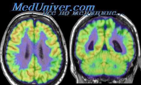 нейроаллергология