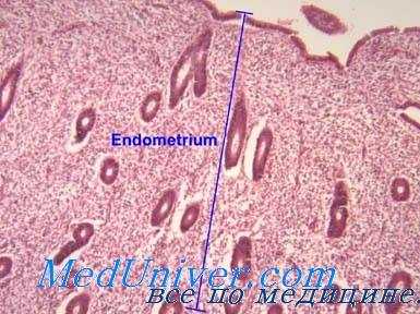 выскабливание матки