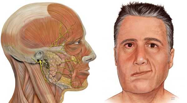 Лицевой нерв и нарушение его иннервации