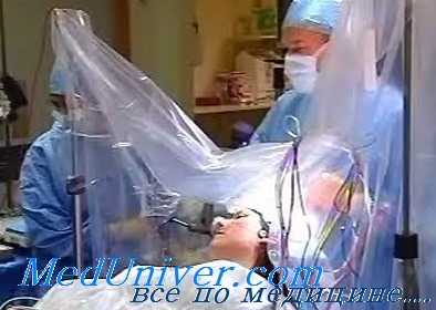 анестезия при невриноме слухового нерва