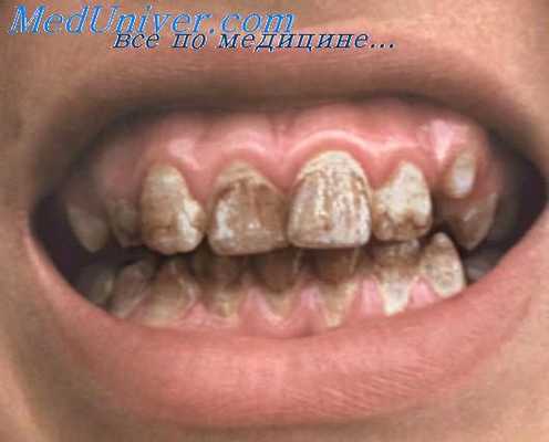 полость рта