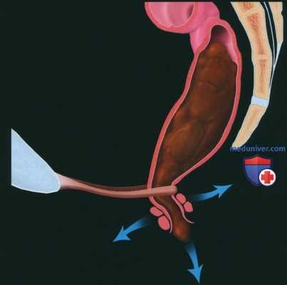 Рентгенограмма, МРТ, УЗИ при недержании кала
