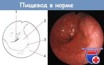 Просвет пищевода в норме
