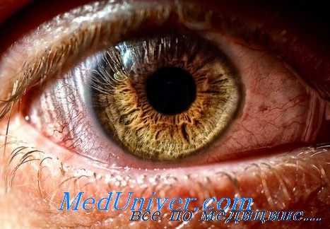 внутриглазная инфекция