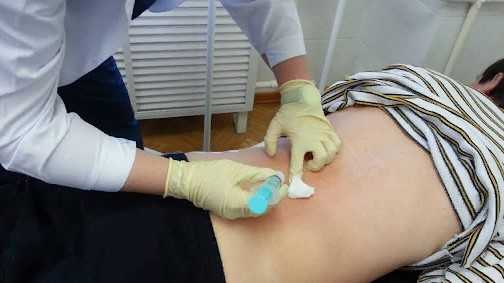 Лечебные блокады проводит лечащий врач