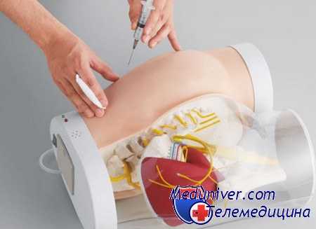 новокаиновая блокада