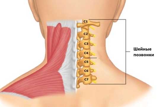 Наиболее уязвимая зона – 7-ой шейный позвонок.