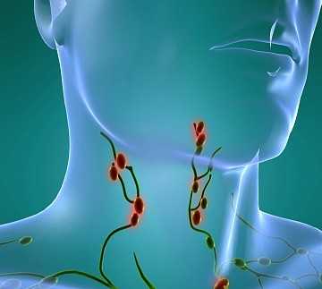 Фото Фиброма лимфоузла на шее