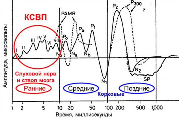 Зображені типові хвилі СВП в дорослої людини