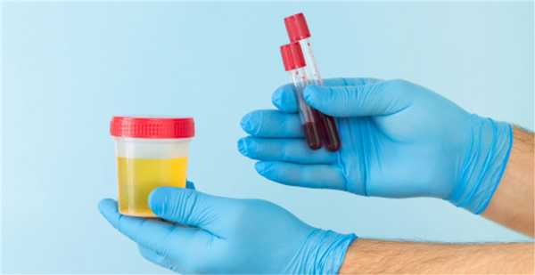 Аденома простаты