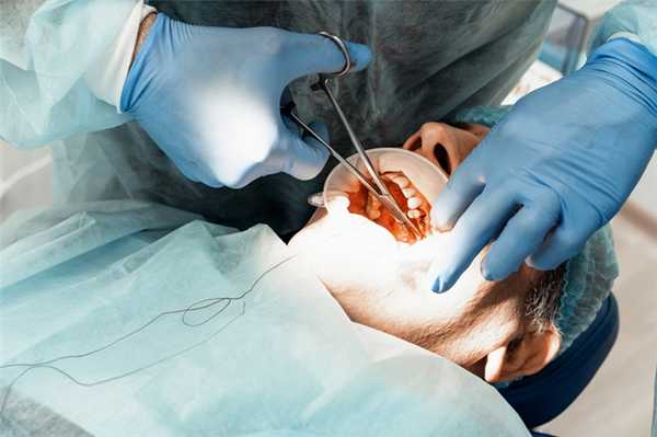 удаление зуба мудрости