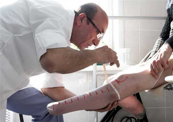 Ампутация нижних конечностей