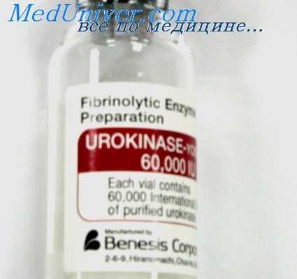 тромболитическая терапия инсульта