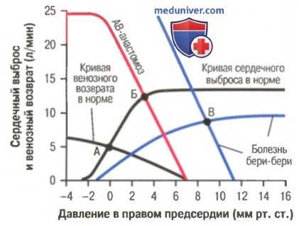 сердечная недостаточность