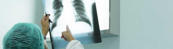 Основные принципы реабилитации для больных с хронической обструктивной болезнью легких