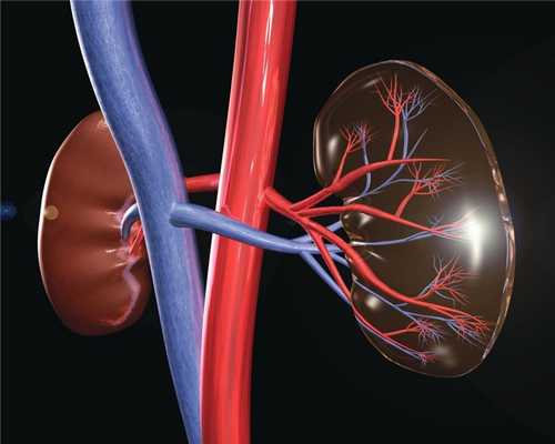 Заболевания сосудов почек