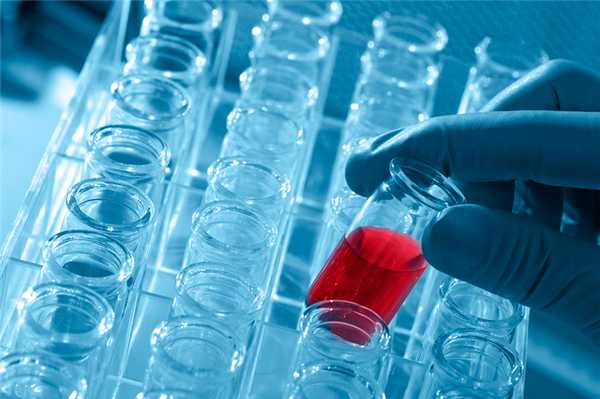 Серологические исследования